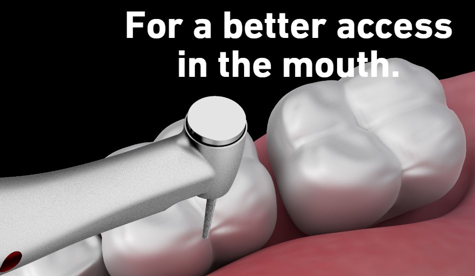 For a Better Access in the Mouth